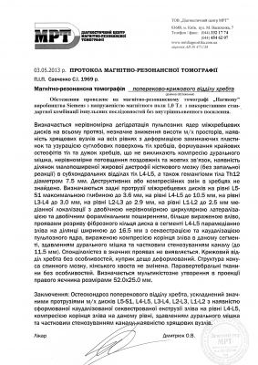 Интраканальная протрузия межпозвонковых дисков