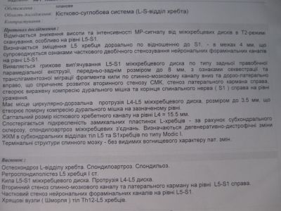 Лечение грыжи позвоночника (Киев)