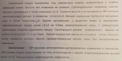 Грыжа позвоночника лечение в Киеве