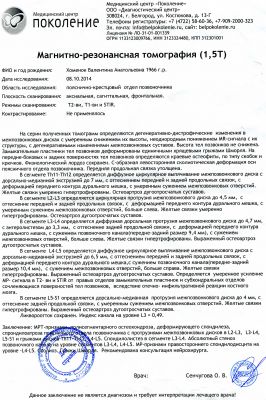 Зарядка при остеохондрозе Украина