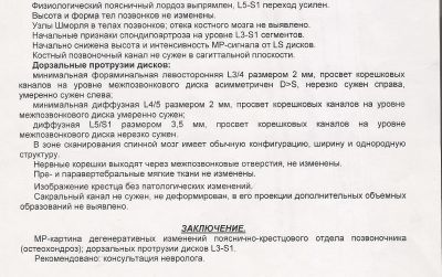 Протрузия поясничного отдела