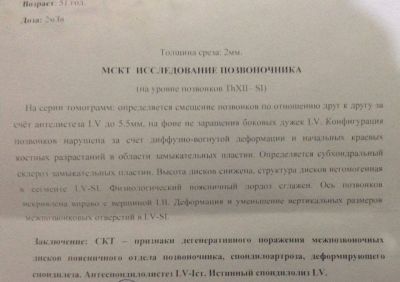 Онемение ног