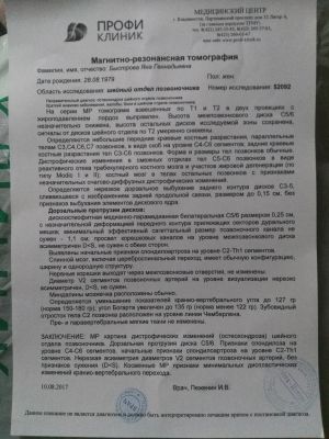 Протрузия диска l4 5