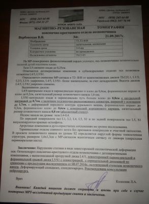 Межпозвонковая грыжа