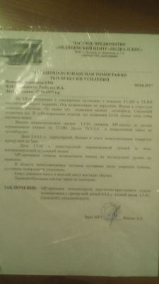 Седалищный нерв симптомы
