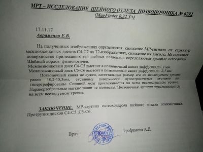 Протрузия межпозвоночных дисков шейного отдела