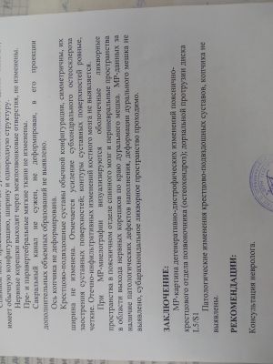 Дорзальная протрузия межпозвонкового диска l4 l5