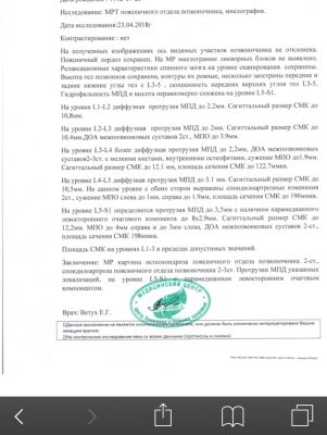 Протрузия с5 6