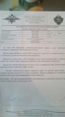 Межпозвоночные грыжи поясничного отдела