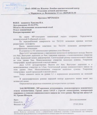 Спондилоартроз что это такое