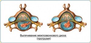 Специалист по позвоночнику