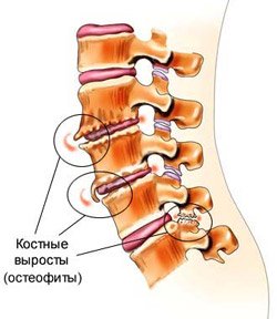 Болят бугорки у основания черепа