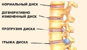 Стук крови в ушах