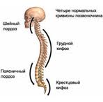 Кифоз