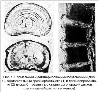 Болит бедро