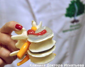Методика вправления позвонков
